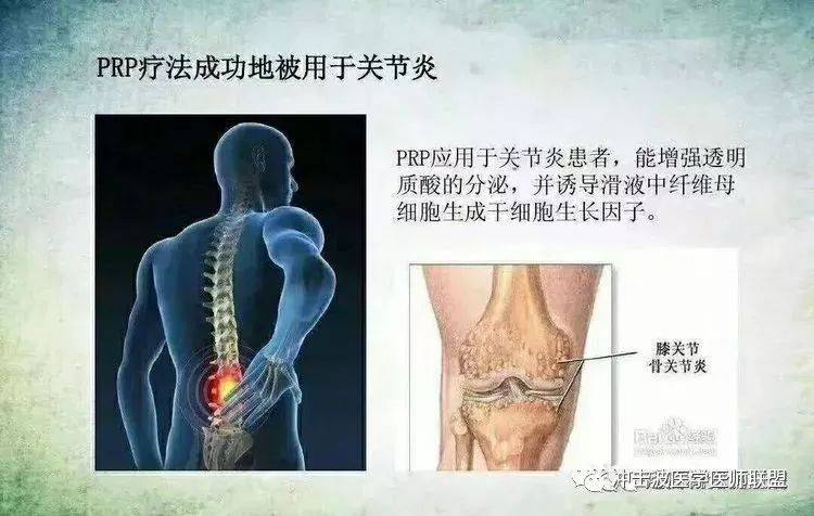 关节软骨再生最新进展，小巷深处的再生奥秘探索